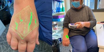 Thanks to a generous donor – Accuvein for Chemotherapy Day Unit Image